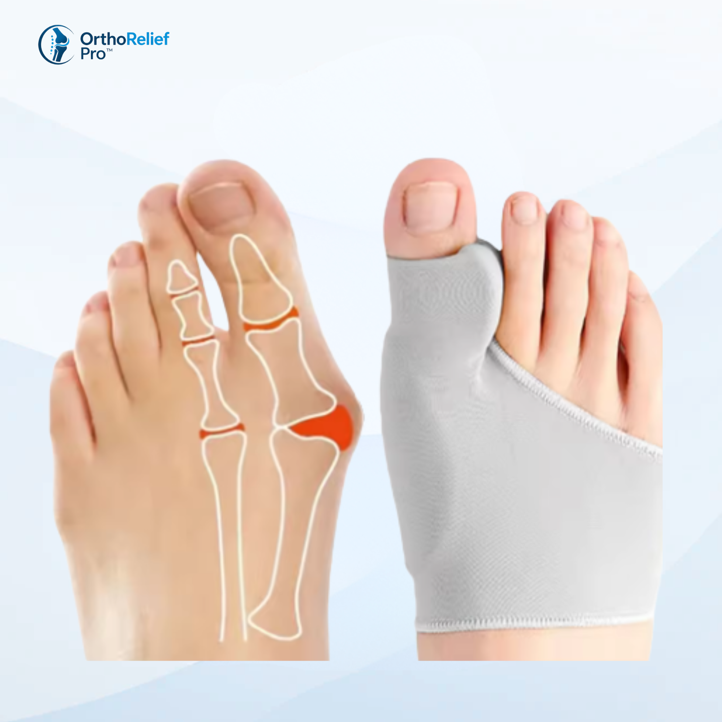 Bunion Alignment Support Sock